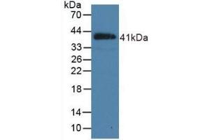 Detection of Recombinant NPPB, Porcine using Polyclonal Antibody to Natriuretic Peptide Precursor B (NPPB) (NPPB antibody  (AA 26-131))