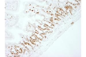 Immunohistochemistry (IHC) image for anti-Antigen Identified By Monoclonal Antibody Ki-67 (MKI67) (AA 1650-1700) antibody (ABIN7448620) (Ki-67 antibody  (AA 1650-1700))