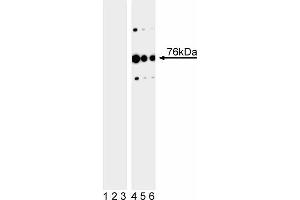 Western blot analysis of SLP-76 (pY113) in human T leukemia.