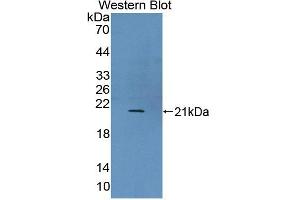 Figure. (UXT antibody  (AA 11-157))