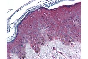 anti-Coronin, Actin Binding Protein, 1C (CORO1C) (AA 375-474) antibody