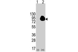 Western blot analysis of RPS6KA1 (arrow) using RPS6KA1 polyclonal antibody . (RPS6KA1 antibody  (Ser732))