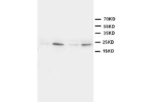 Anti-HMGB4 antibody, Western blotting Lane 1: Rat Brain Tissue Lysate Lane 2: Rat Testis Tissue Lysate Lane 3: JURKAT Cell Lysate Lane 4:  Cell Lysate (HMGB4 antibody  (N-Term))