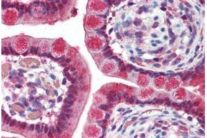 anti-Tumor Necrosis Factor Receptor Superfamily, Member 10a (TNFRSF10A) antibody