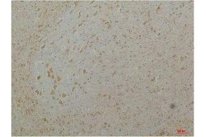 Immunohistochemistry (IHC) analysis of paraffin-embedded Mouse Brain Tissue using Cav1. (CACNA1D antibody)