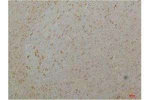 Immunohistochemistry (IHC) image for anti-Calcium Channel, Voltage-Dependent, L Type, alpha 1D Subunit (CACNA1D) antibody (ABIN3181660)