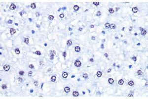 Immunohistochemistry of paraffin-embedded Rat liver using CHD4 Polyclonal Antibody at dilution of 1:100 (40x lens). (CHD4 antibody)