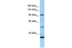 Western Blotting (WB) image for anti-Receptor Tyrosine Kinase-Like Orphan Receptor 1 (ROR1) (N-Term) antibody (ABIN2789669)