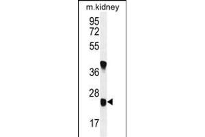 U119B Antibody (C-term) (ABIN654979 and ABIN2844619) western blot analysis in mouse kidney tissue lysates (35 μg/lane). (UNC119B antibody  (C-Term))