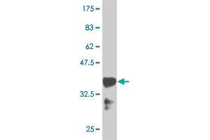 Western Blot detection against Immunogen (36. (HOXB9 antibody  (AA 65-163))