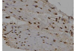 ABIN6276493 at 1/100 staining Human gastric tissue by IHC-P. (NUAK2 antibody  (Internal Region))