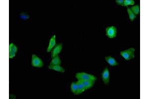Immunofluorescent analysis of HepG2 cells using ABIN7157794 at dilution of 1:100 and Alexa Fluor 488-congugated AffiniPure Goat Anti-Rabbit IgG(H+L) (Lactate Dehydrogenase A antibody  (AA 5-323))