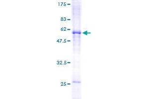 Image no. 1 for Src-Like-Adaptor (SLA) (AA 1-276) protein (GST tag) (ABIN1320095) (SLA Protein (AA 1-276) (GST tag))