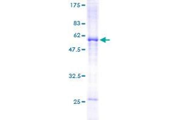 SLA Protein (AA 1-276) (GST tag)