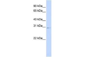 Western Blot showing HOXA9 antibody used at a concentration of 1-2 ug/ml to detect its target protein. (HOXA9 antibody  (Middle Region))