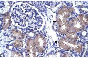 Human kidney (ASCL1 antibody  (N-Term))