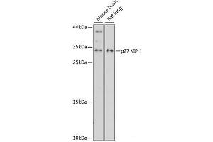 Western blot analysis of extracts of various cell lines using p27 KIP 1 Polyclonal Antibody at dilution of 1:3000. (CDKN1B antibody)