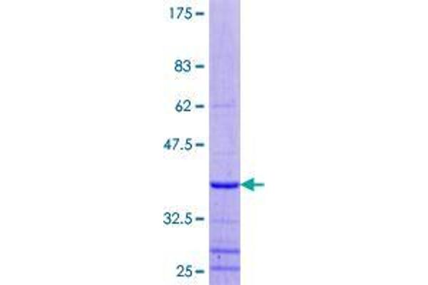 LUC7-Like 3 Protein (LUC7L3) (AA 1-79) (GST tag)