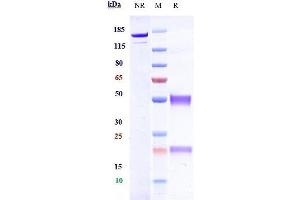 Anti-RGMC / HFE2 Reference Antibody (DISC-0974) on SDS-PAGE under reducing (R) condition.