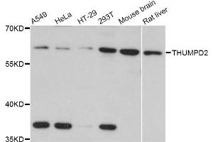 Western blot analysis of extracts of various cell lines, using THUMPD2 Antibody (ABIN4905417) at 1:3000 dilution. (THUMPD2 antibody)