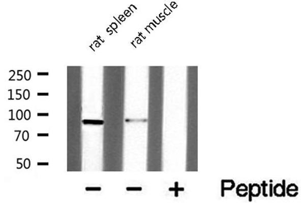 DYRK1A antibody  (N-Term)
