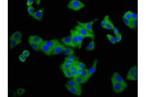 Immunofluorescence staining of HepG2 cells with ABIN7148726 at 1: 133, counter-stained with DAPI. (CSMD3 antibody  (AA 233-380))