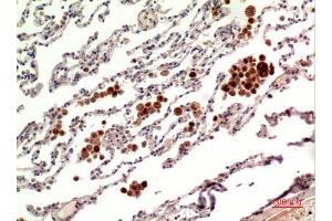 Immunohistochemistry (IHC) analysis of paraffin-embedded Human Lung, antibody was diluted at 1:100. (RANKL antibody  (C-Term))