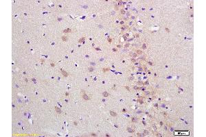 Formalin-fixed and paraffin embedded rat brain labeled with Anti-Cytosine deaminase Polyclonal Antibody, Unconjugated (ABIN682138) at 1:200 followed by conjugation to the secondary antibody and DAB staining (Cytosine Deaminase antibody)