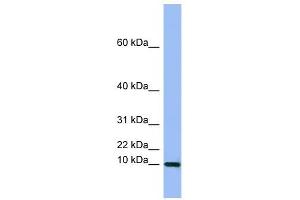 Semenogelin I antibody used at 1 ug/ml to detect target protein. (SEMG1 antibody  (Middle Region))