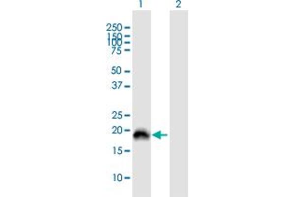 PRELID2 antibody