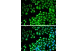 Immunofluorescence analysis of U2OS cells using KMT2E antibody (ABIN5973619). (MLL5/KMT2E antibody)