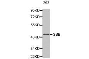 Western Blotting (WB) image for anti-Sjogren Syndrome Antigen B (SSB) antibody (ABIN1874948) (SSB antibody)