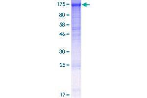 DDB1 Protein (AA 1-1140) (GST tag)