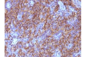 Immunohistochemistry (IHC) image for anti-Chromogranin A (CHGA) antibody (ABIN6939132)