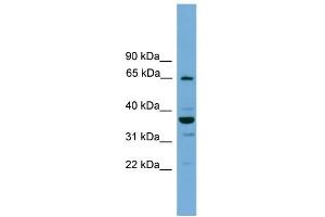 WB Suggested Anti-TH1L Antibody Titration: 0. (TH1-Like antibody  (N-Term))