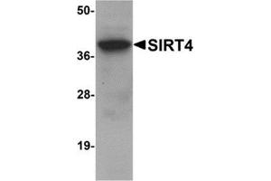 Western blot analysis of SIRT4 in human liver tissue lysate with SIRT4 antibody at 1 μg/ml.