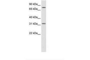 Image no. 1 for anti-Wingless-Type MMTV Integration Site Family, Member 8B (WNT8B) (AA 181-230) antibody (ABIN202313) (WNT8B antibody  (AA 181-230))