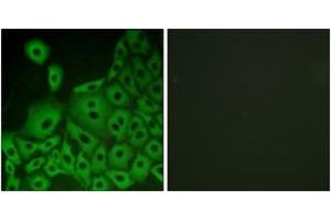 Immunofluorescence analysis of A549 cells, using GPR153 Antibody.