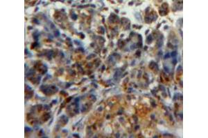 Used in DAB staining on fromalin fixed paraffin-embedded pancreas tissue (PDIA2 antibody  (AA 309-525))