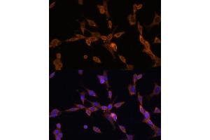 Immunofluorescence analysis of NIH/3T3 cells using UBE2J1 antibody (ABIN7271172) at dilution of 1:100. (UBE2J1 antibody  (AA 1-100))