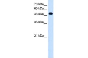 Western Blotting (WB) image for anti-Protein tyrosine Phosphatase, Receptor Type, R (PTPRR) antibody (ABIN2462848)