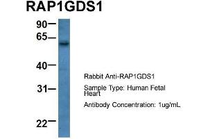 Host: Rabbit  Target Name: RAP1GDS1  Sample Tissue: Human Fetal Heart  Antibody Dilution: 1.