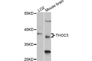 Western blot analysis of extracts of various cell lines, using THOC3 antibody (ABIN6290993) at 1:3000 dilution.
