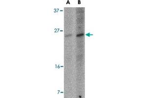 Western blot analysis of BBC3 expression in K-562 cell lysate with BBC3 monoclonal antibody, clone 10D4G7  at (A) 2.