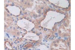 IHC-P analysis of Human Kidney Tissue, with DAB staining. (SLC12A3 antibody  (AA 3-146))