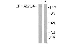 Western Blotting (WB) image for anti-EPH Receptor A2/3/4 (EPHA2/3/4) (Tyr588), (Tyr596) antibody (ABIN1848022) (EPHA2/3/4 antibody  (Tyr588, Tyr596))