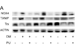 Effects of PU on the high glucose-induced inflammasome signaling pathway. (TXNIP antibody  (AA 1-166))