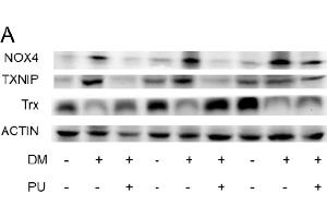 TXNIP Antikörper  (AA 1-166)