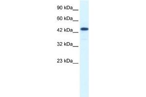 WB Suggested Anti-RCOR3 Antibody Titration:  1. (RCOR3 antibody  (N-Term))
