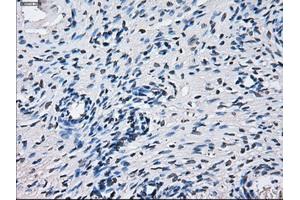 Immunohistochemistry (IHC) image for anti-Cytochrome P450, Family 2, Subfamily E, Polypeptide 1 (CYP2E1) antibody (ABIN2718987)